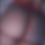 chelxie nue leak mym